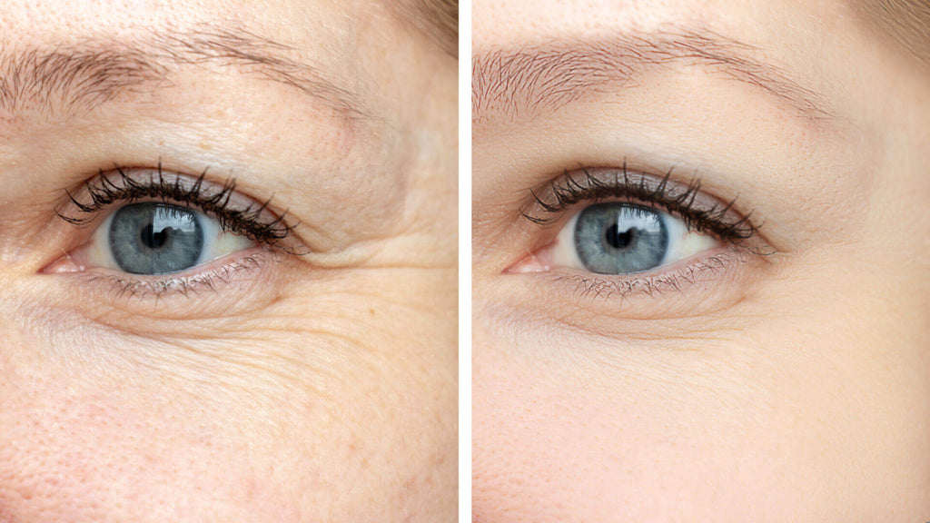 Eye Love Eye Gel image 1