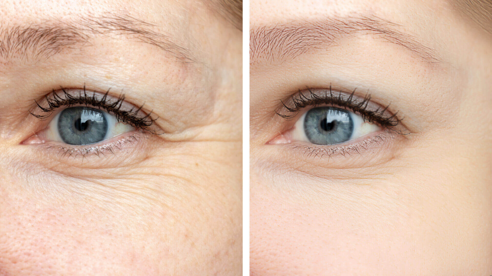 Eye Love Eye Gel image 1