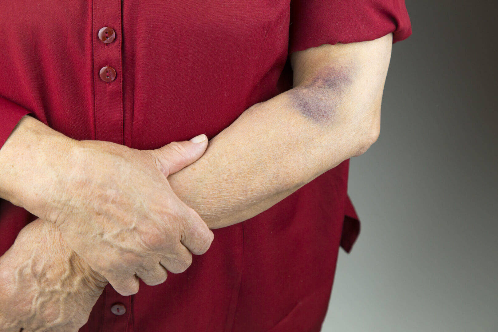 Homeopathic Bruise and Scar Cream image 1